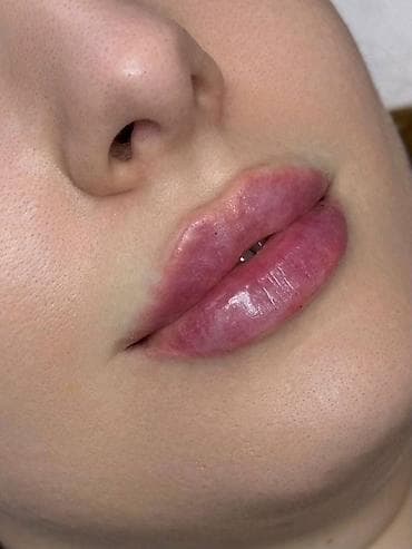 увеличение грудей бишкек цена: Косметология, Увеличение губ, Консультация — 3