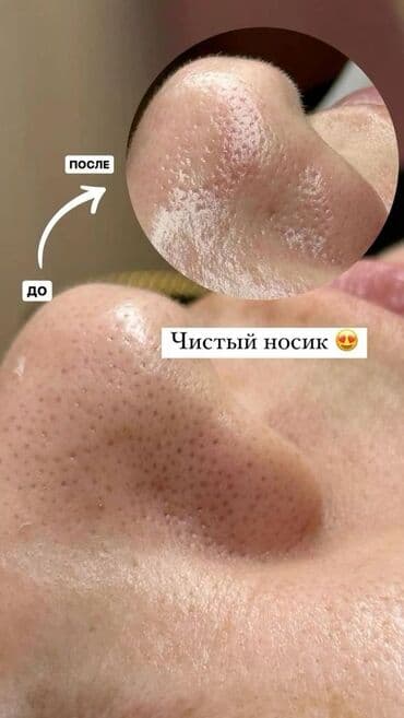 частный роддом бишкек цены: Косметология, Пилинг, Ботулинотерапия, Плазмолифтинг, Консультация, Требуются модели, Сертифицированный косметолог — 11