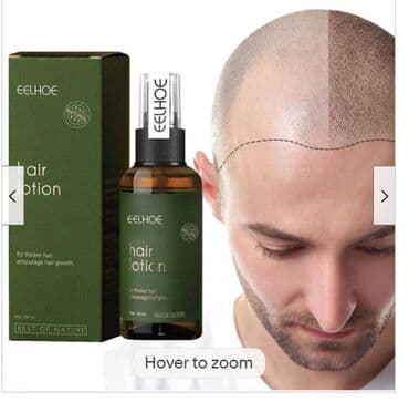 личный кабинет эрсаг кыргызстан: ❄️ С️ША Сыворотка для роста волос и бороды blusoms folligrow — 2