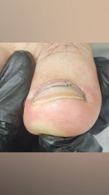 сколько стоит обучение на мастера маникюра: Коррекция вросших ногтей, Маникюр, Педикюр, Услуги подолога, Консультация, Одноразовые расходные материалы — 6