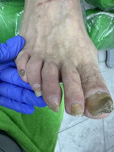 dyson styler: Педикюр, Одноразовые расходные материалы — 9