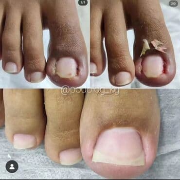 маникюр педикюр с выездом на дом: Выравнивание, Наращивание ногтей, Донаращивание ногтей, Маникюр, Педикюр, Услуги подолога, С выездом на дом, Консультация, Одноразовые расходные материалы — 8