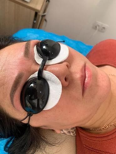 удаление татуажа и татуировок: Лазерное удаление бровей.🌸 Перманентный макияж бровей 🌸 Лазер нового — 2