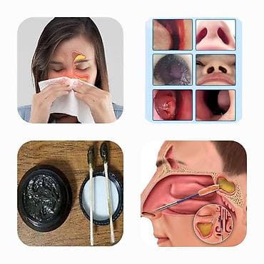 тибет: Тибетская мазь для носа от ринита и гайморита Что это: - Плотная — 2