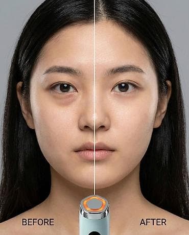 ring light: Аппараты для домашнего лифтинга от mommy care: PentaPrime и V-THERA — 5