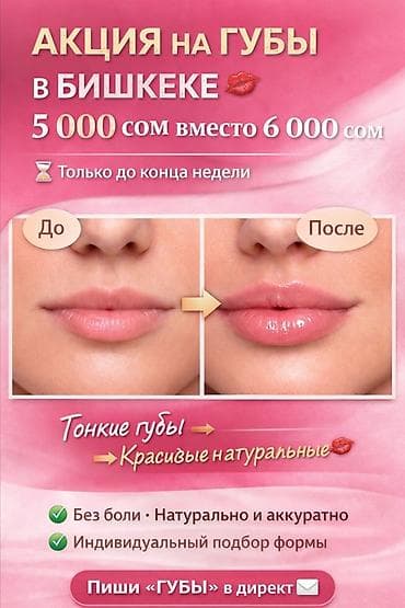 камуфляж форма бишкек: Увеличение и коррекция губ в Бишкеке - Акция: 5 000 сом вместо 6 000 — 2
