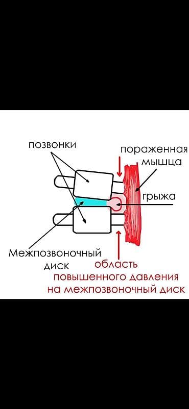 Массаж: Массаж | Сутулость, нарушение осанки | С выездом на дом, Консультация — 3