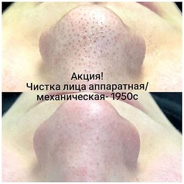 акнекутан цена: Косметология, Пилинг, Разглаживание и коррекция морщин, Чистка кожи, Консультация, Сертифицированный косметолог, Гипоаллергенные материалы — 1