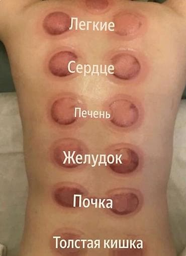 Массаж | Лечебный массаж | С выездом на дом