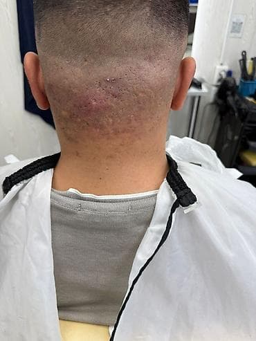 ersag: Массажный крем Cleanball ERSAG Описание: - Крем для массажа в тюбике — 2