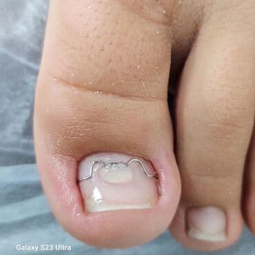 самый лучший эндокринолог рядом просп жибек жолу бишкек: Коррекция вросших ногтей, Услуги подолога, Маникюр, Педикюр, Одноразовые расходные материалы, Консультация — 5