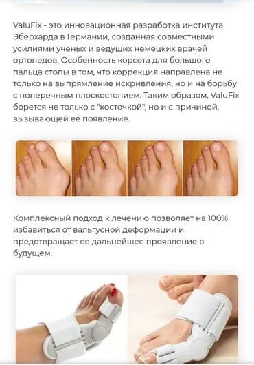 Кислородные подушки: Valufix- hallfix фиксатор от вальгусной деформации +бесплатная — 26