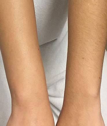 кератиновое выпрямление бишкек цена: Уважаемые клиенты! 🥰Мы рады предложить вам услугу лазерной эпиляции — — 3