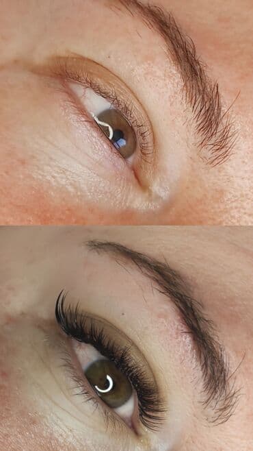 узи с выездом на дом бишкек: Ресницы, Классика, 2D, 3D, Консультация, Гипоаллергенные материалы — 13