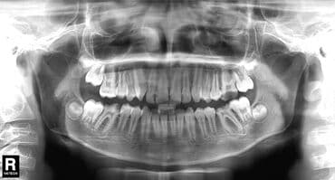с достук: Продается Панорамный рентген 2д 2011 года vatech pax 400c всё работает — 3