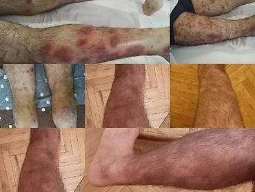 массаж частный: Лечебный массаж. Пробный сеанс и консультация специалиста со скидкой — 2