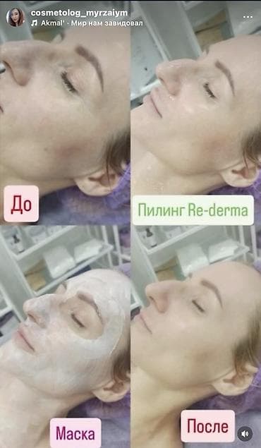 для кожы: Косметология, Чистка кожи, Консультация, Сертифицированный косметолог — 4
