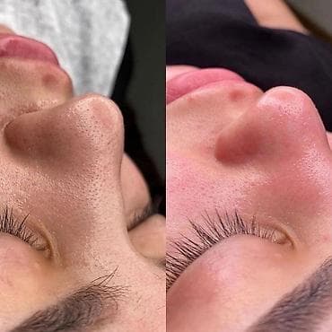 косметолог эстетист услуги: Косметология, Чистка кожи, Массаж лица, Лечение угревой болезни, С выездом на дом, Сертифицированный косметолог, Консультация — 3