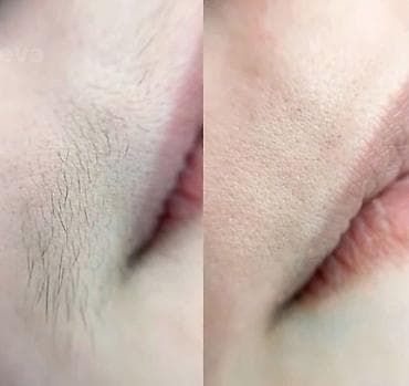 пилинг для мужчин: Восковая депиляция для женщин и мужчин Подмышки - 500 сом — 9