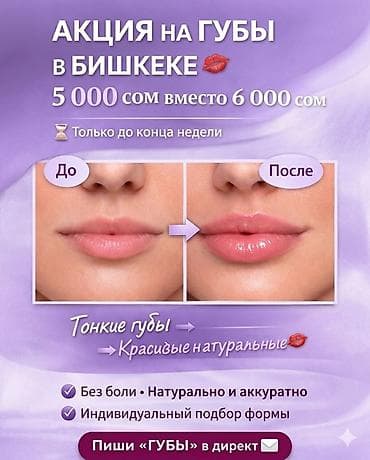 камуфляж форма бишкек: Увеличение и коррекция губ в Бишкеке - Акция: 5 000 сом вместо 6 000 — 3