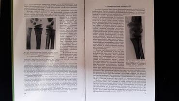 журналы об искусстве: Рейнберг С.А. Рентгенодиагностика заболеваний костей и суставов. В — 7