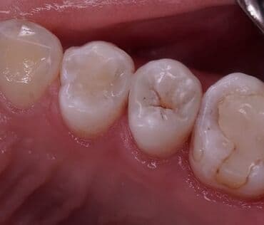 лучший детский стоматолог бишкек: Стоматолог Бишкек. Профессиональная чистка. Лечение кариеса и его — 8