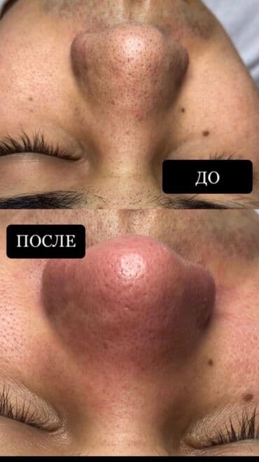 ремонт меховых изделий: 13 этапная чистка !!! безопасный абсолютно безболезненный. Результат — 1