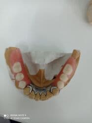 обучение медсестры: Обучение зубных техников металлокерамика восковое моделирование — 2