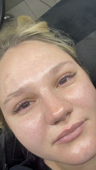 сколько стоит поставить брекеты на зубы в бишкеке: Наращивание ресниц - Классическое и объемное наращивание с — 1