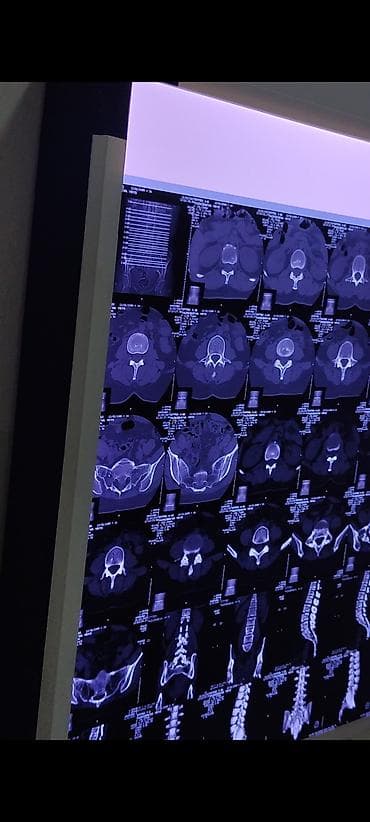 Медицинская одежда: Просветитель (негатоскоп) для рентгеновских пленок и МРТ/КТ-снимков - — 1