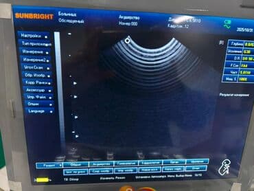 Срочно продаю Новый Портативный УЗИ аппарат 3D аппарат SUNBRIGHT с — 6