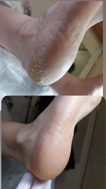 обработка: Выравнивание, Наращивание ногтей, Гель лак, шеллак, Педикюр, Одноразовые расходные материалы, Услуга в 4 руки — 2