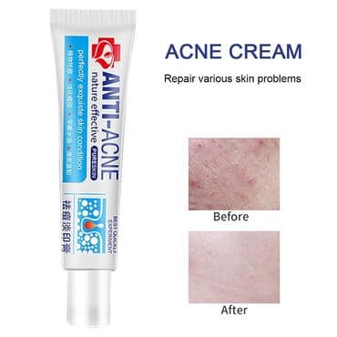 шампунь дисаар: Травяной крем для акне и угрей Со сроком до 24.02.2023года -50% — 4