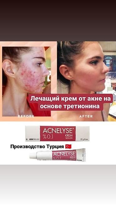 Третиноин крем Производитель Турция  Acnelyse krem Tretinoin 0.1%