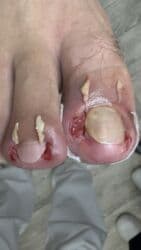 арендовать дом: Выравнивание, Услуги подолога, С выездом на дом, Консультация, Одноразовые расходные материалы — 25