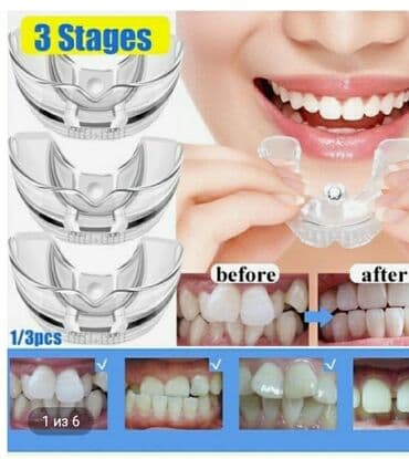 резиновый дилдо: Зубные ортодонтические брекеты для выравнивания зубов. Материал — 2