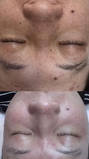 МУЖСКАЯ И ЖЕНСКАЯ ПРОФЕССИОНАЛЬНАЯ ЧИСТКА Лица 1900сом 14 этапная