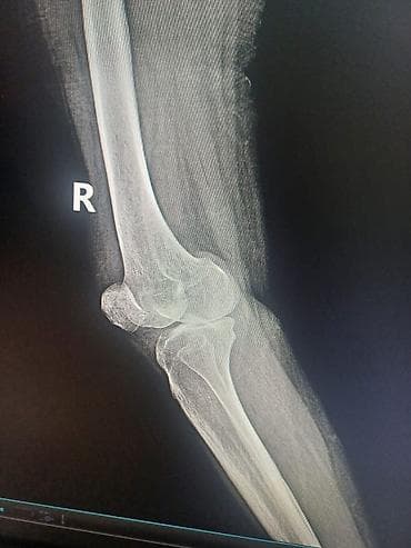 Медбрат, ищу подработку, могу установить, снять катетеры, виды