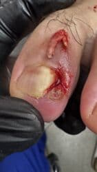 арендовать дом: Выравнивание, Услуги подолога, С выездом на дом, Консультация, Одноразовые расходные материалы — 44