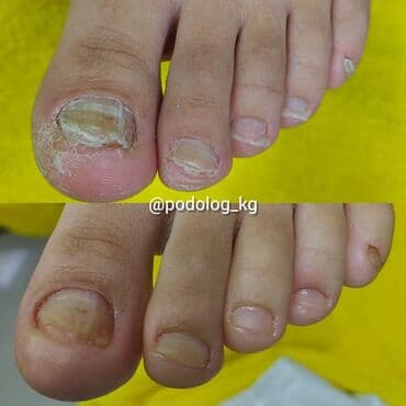 сколько стоит обучение на мастера маникюра: Коррекция вросших ногтей, Маникюр, Педикюр, Услуги подолога, Консультация — 10