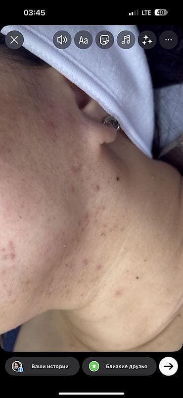 выезд массаж бишкек: МУЖСКАЯ И ЖЕНСКАЯ ПРОФЕССИОНАЛЬНАЯ ЧИСТКА Лица 1900сом 14 этапная — 7