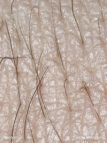 120 гц: Poco X7 Pro, Б/у, 256 ГБ, цвет - Черный, 2 SIM — 6