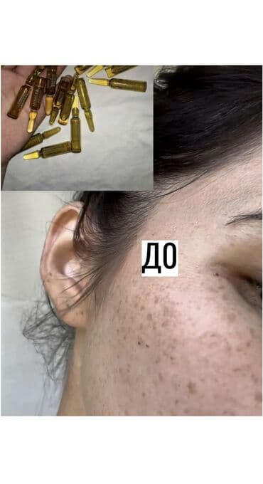 крем для отбеливания кожи и устранения пигментных пятен: JUWAY 377 — отбеливающая эссенция против пигментации и акне в ампулах — 2