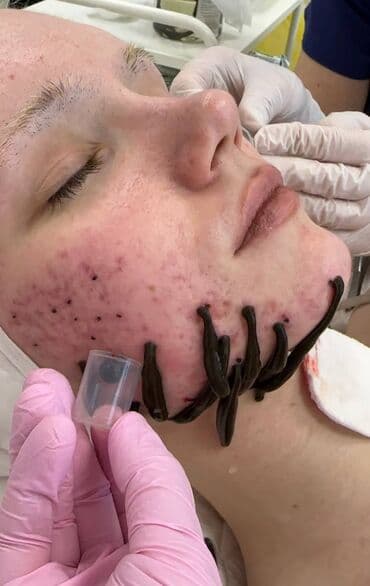 медицинский массаж курсы: Косметология, Демодекоз, Контурное моделирование, Лечение угревой болезни, Консультация, Гипоаллергенные материалы, Сертифицированный косметолог — 21