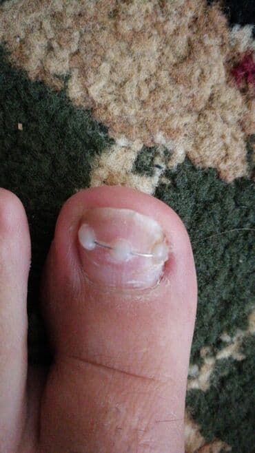 самый лучший эндокринолог рядом просп жибек жолу бишкек: Воосшие ногти, заболевания ногтей, стопы, бородавки, мозоли — 4