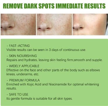 эффективный отбеливающий крем для зоны бикини в аптеке: ❄️ США Крем интенсивное отбеливание с Аmazon и Еbay Крем дает ▶ — 2