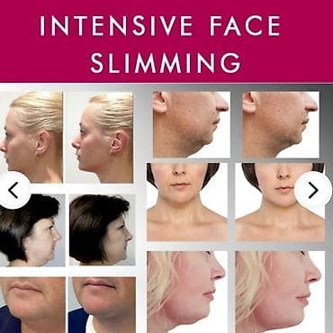 щека: Бандаж для подбородка. корейский бандаж для подбородка.только — 4