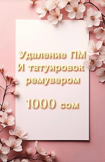 обучение тату: Удаление татуировок — 1