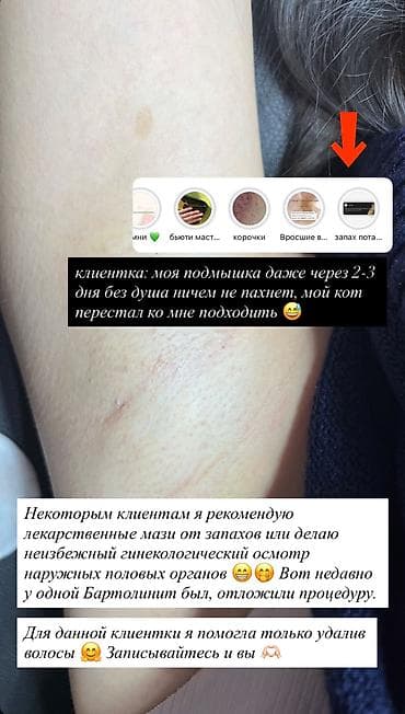 Сулуулук жана ден-соолук: Электроэпиляция — профессиональное удаление волос с любой зоны — 3