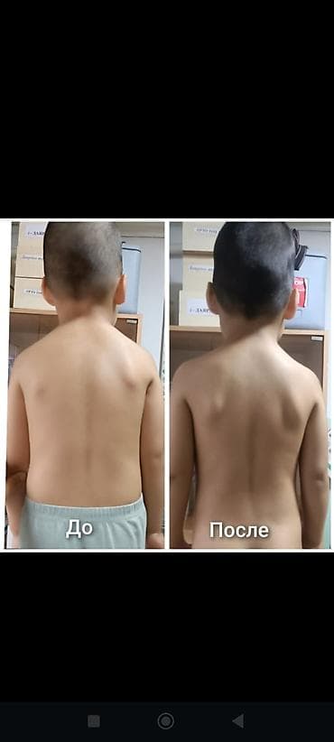 Массаж: Массаж | Детский массаж | Сутулость, нарушение осанки — 1